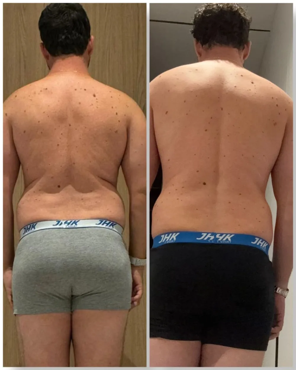 Ángel, antes y después: -8 KG con EMFIT