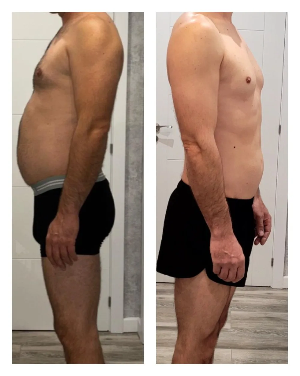 Florín, antes y después: -9 KG con EMFIT