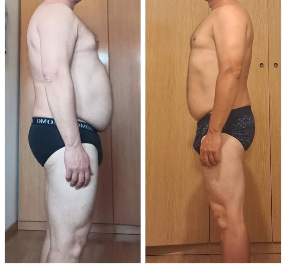 Jordi, antes y después: -8 KG con EMFIT