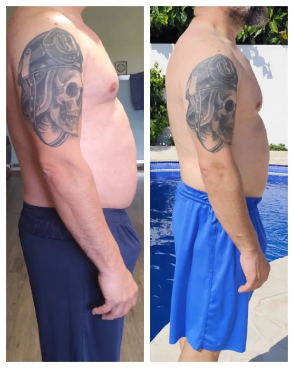 Pol, antes y después: -5 KG con EMFIT