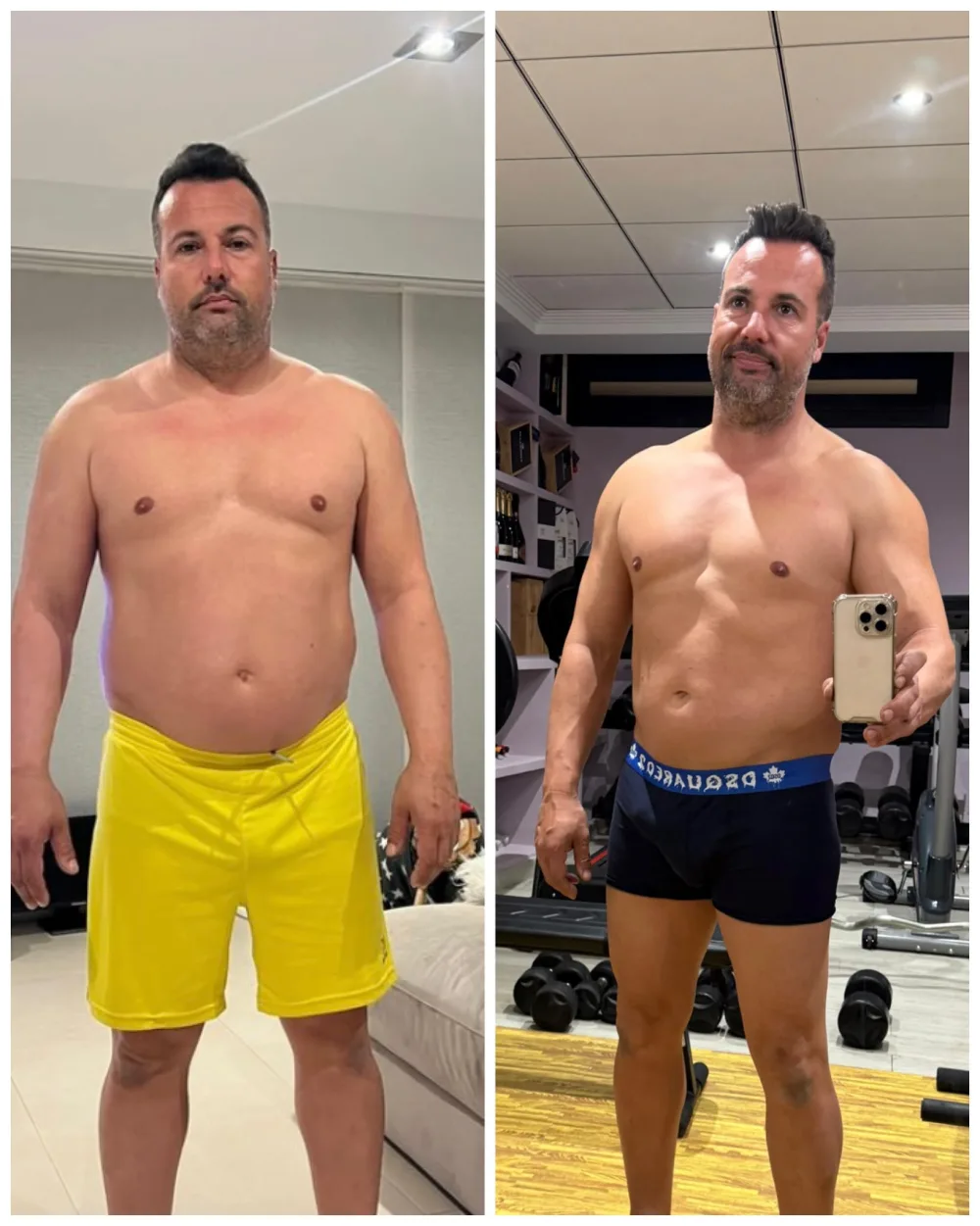 Riki, antes y después: -20 KG con EMFIT