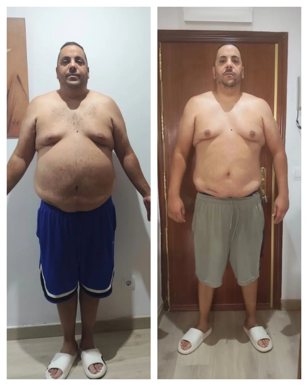 Sergio, antes y después: -22 KG con EMFIT
